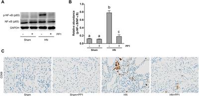 Pharmacological inhibition of Src family kinases attenuates hyperuricemic nephropathy